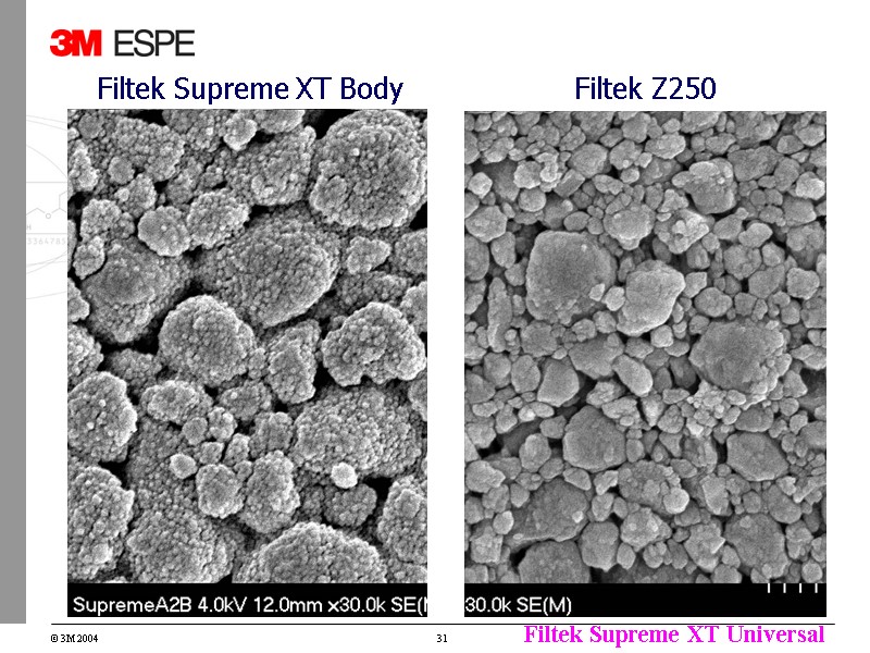 Filtek Supreme XT Body Filtek Z250 Filtek Supreme XT Body Filtek Z250
